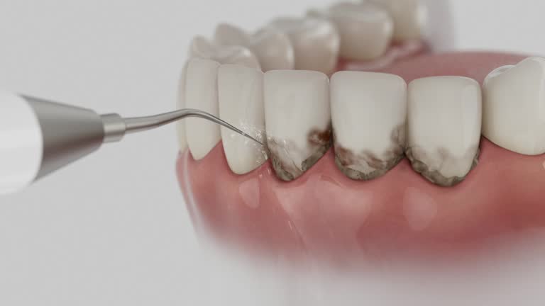 Reliable Invisalign Clear Aligners contractor in McDowell County County, WV by Dentist Open Now